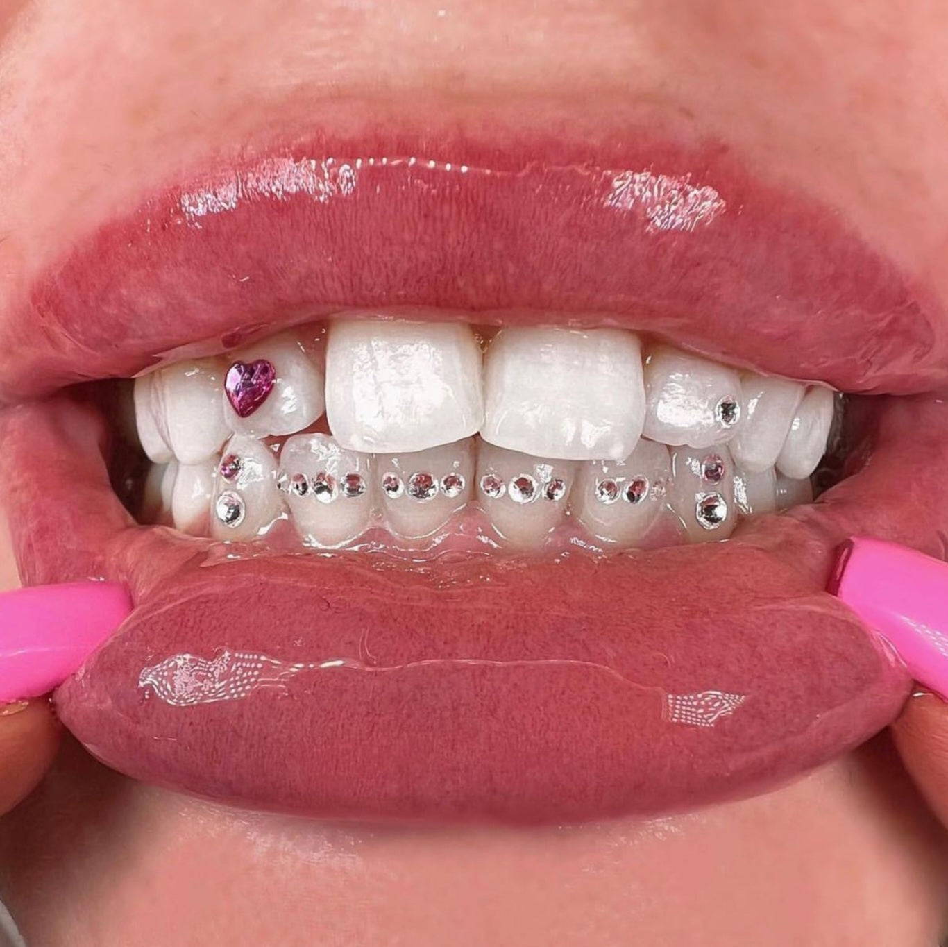SelfGem™ DIY Tooth Gem Kit | Rose & Blue Set (6 stuks)
